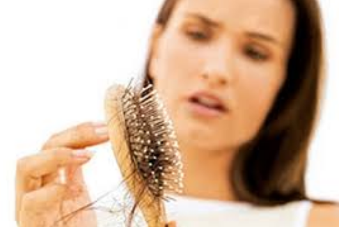 triệu chứng rụng tóc ở nữ giới